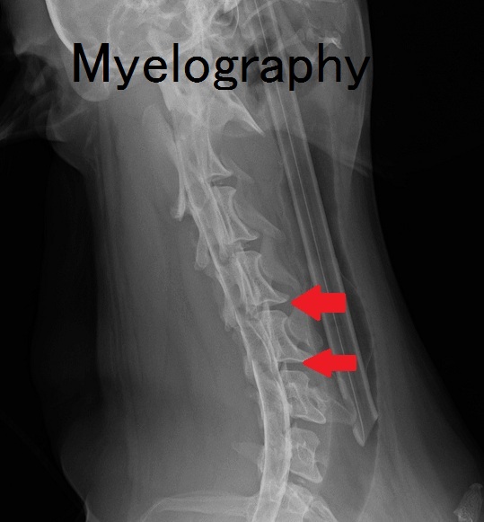 Myelography　Cervical